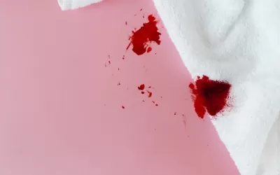 Kan Lekesi Nasıl Çıkar?